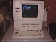 узи aloka ssd 500