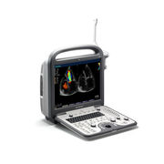 Ультразвуковые аппараты SonoScape