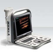 Купить аппарат УЗИ SonoScape A6