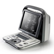 УЗИ Аппарат (Сканер) SONOSCAPE A6