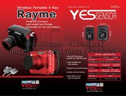 Визиограф, радиовизиограф, радиовизиограф стоматологический, Yes Biote