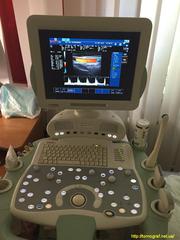 Продажа УЗИ аппарата: Esaote MyLab X-Vision 2011 г.