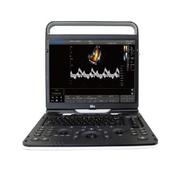 Ультразвуковой сканер Chison Ebit 60