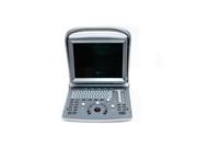 Новый сканер УЗИ Chison ECO5